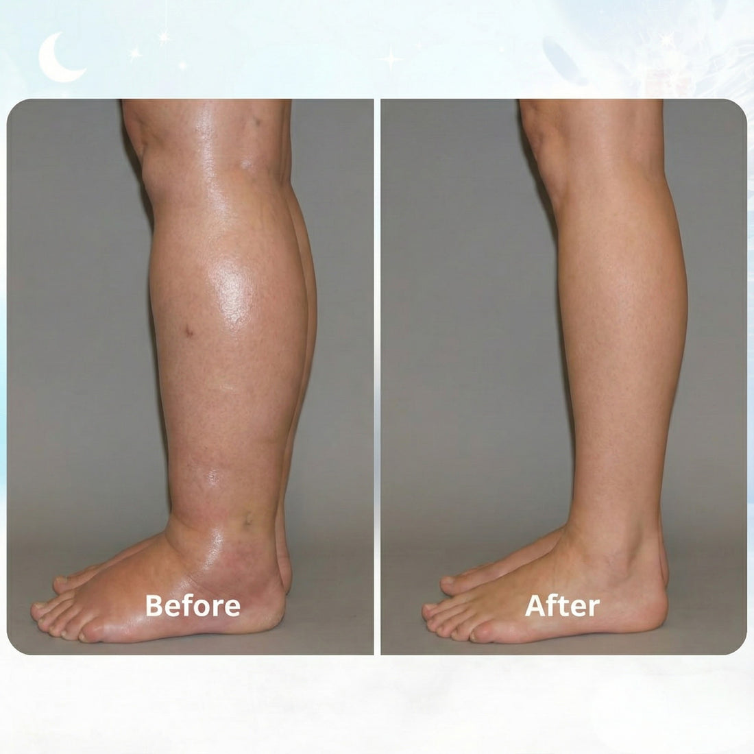 SELVELA - EMS FIX SWOLLEN LEGS FROM HOME