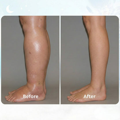 SELVELA - EMS FIX SWOLLEN LEGS FROM HOME