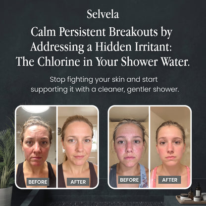 Selvela Filtered Showerhead