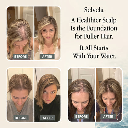 Selvela Filtered Showerhead
