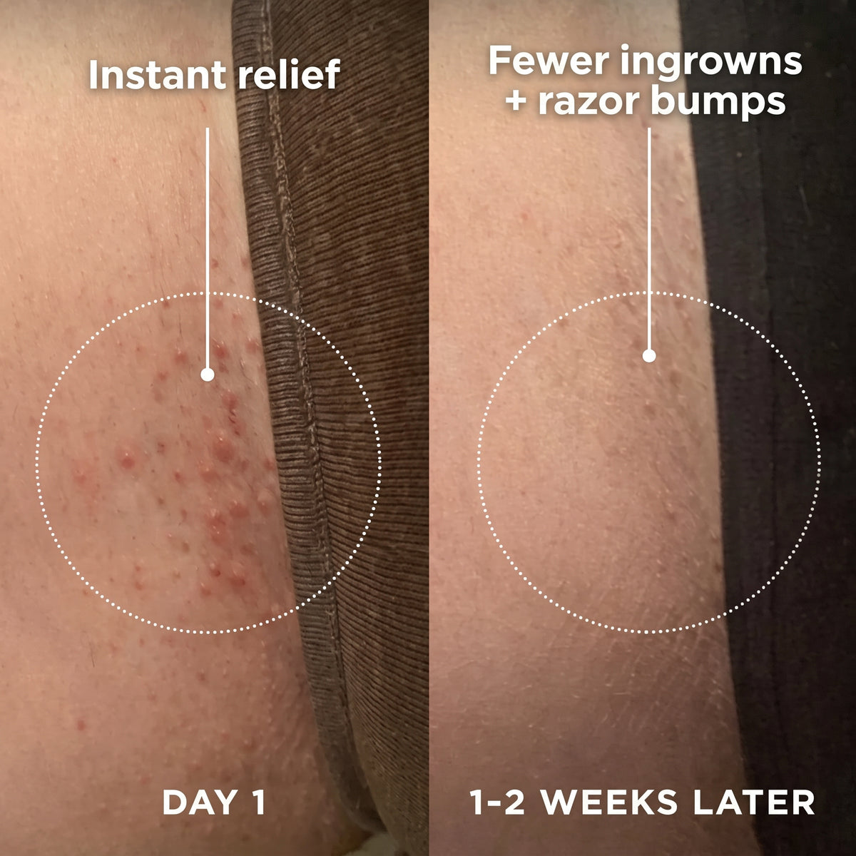 Selvela Smoothing Solution