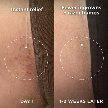 Selvela Smoothing Solution