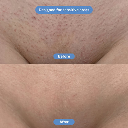 Selvela Smoothing Solution